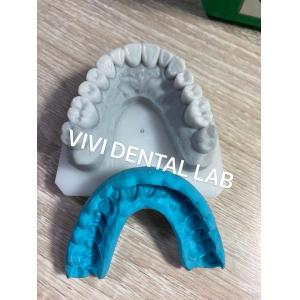 Stable Dental Crown Diagnostic Wax Up For Orthodontic Treatment