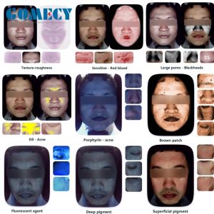 China GMS- A6 Al Intelligent Face Analyzer Machine 15 Skin Problems Analysis With 8 Spectral Imaging Technologies wholesale
