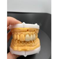 China Precision Fit Digital Crowns Implant Dentrues With Compatibility Email Transmission Mode on sale