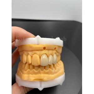 Precision Fit Digital Crowns Implant Dentrues With Compatibility Email Transmission Mode
