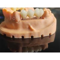 China High Toughness Zirconia Based Ceramics Material For Dental Applications on sale