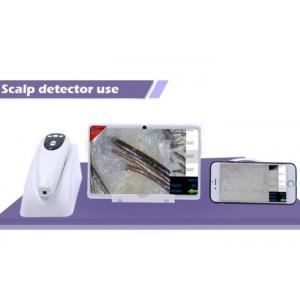 Digital Microscope for Skin and Scalp Video Dermatoscope with 2 Million Pixels