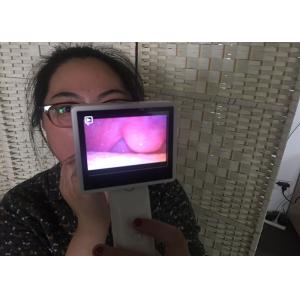 China ENT Endoscopy Rhinoscopy Medical Video Camera Digital Otoscope For Nose Checking With LCD Screen supplier