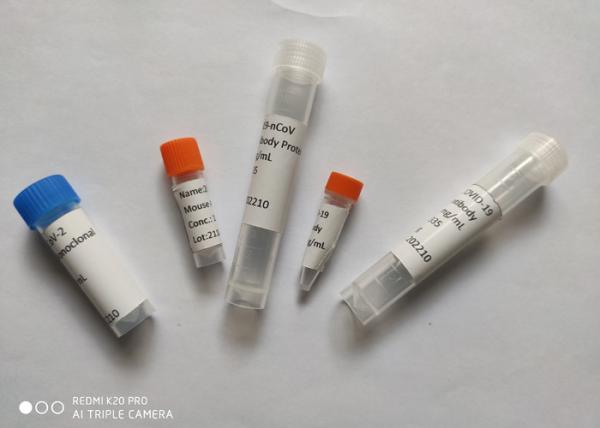 Recombinant 2019-NCoV Mouse Monoclonal Antibody Spike RBD Protein
