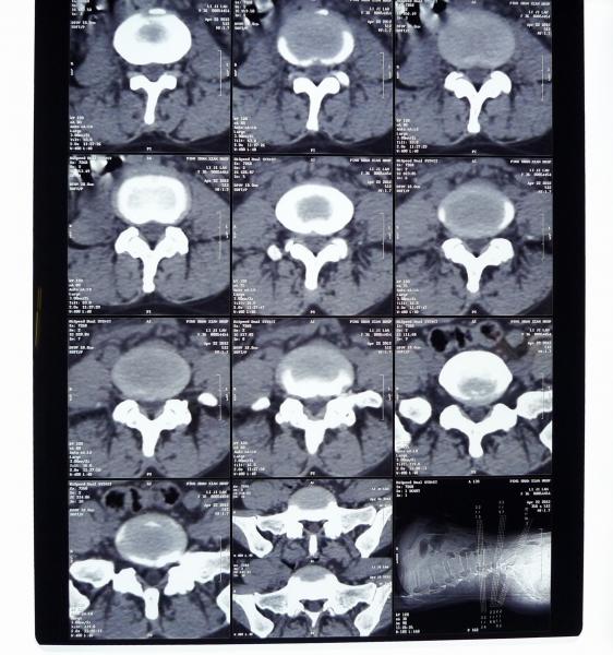 10in * 12in films secs d'imagerie médicale à haute densité de 11in * de 14in