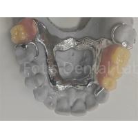 China FDA Easy To Clean Removable Partial Denture Compatible With Natural Teeth on sale