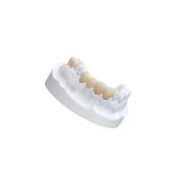 China IPS E Max Ceramic Dental Crown Comfortable Porcelain Composite Veneers on sale