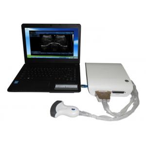 High Resolution Portable Ultrasound Scanner 3D B / W Ultrasound Box With USB Port