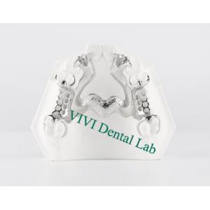 Skelete Chrome Metal Partial Denture Printed CoCr Denture Design