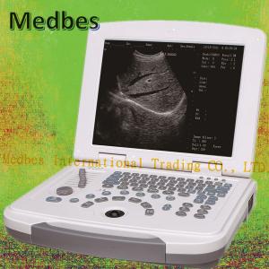 China Professional Ultrasound Imaging System 15 Inch LED Laptop Hospital Machine supplier