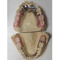 China Customization Temporary Partial Dentures Compatible With Natural Teeth on sale