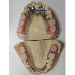 Customization Temporary Partial Dentures Compatible With Natural Teeth