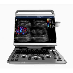 Portable Cardiac Ultrasound Machine Chison EBit 50 16.5lbs