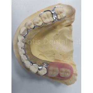Replace Missing Teeth Removable Partial Denture Dental Prosthesis Flexible Design