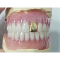 China Comfortable Precision Fit Full Acrylic Denture Prosthesis With Natural Teeth on sale
