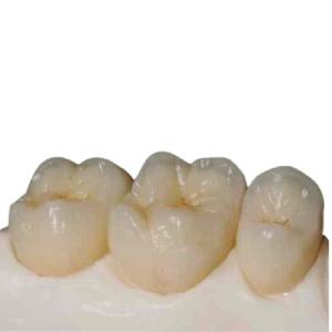 China High Strength Zirconia Ceramic Teeth Precision Digitally Manufactured supplier