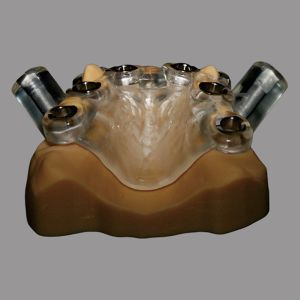 China カスタム 透明性 歯科インプラント ソリューション 手術ステント エルゴノミクス デザイン wholesale