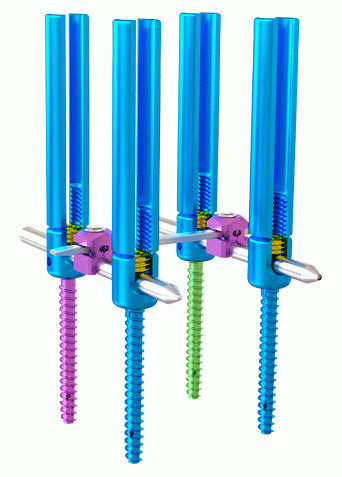 China Type spinal interne de système de fixationⅠ d'une façon minimum envahissant supplier