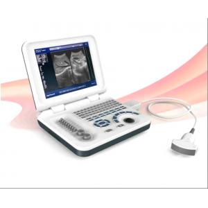 Diagnostic Laptop Ultrasound Machine Digital Ultrasound Scanner Durable