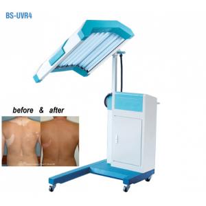 China Phototherapy Treatment UVB Light Therapy Machine , UVB Narrow Band Light Therapy supplier