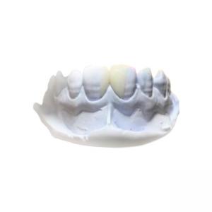 China Efficient Resin Removable PFM Dental Crown Health Materials supplier