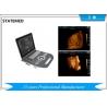 36.9×38×79 CM Laptop Ultrasound Scanner / 6.5 Kg Portable Baby Ultrasound
