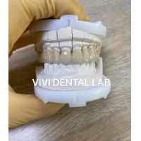 China Precise Dental Lab Crowns Esthetic Porcelain Zirconia Tooth Crown on sale