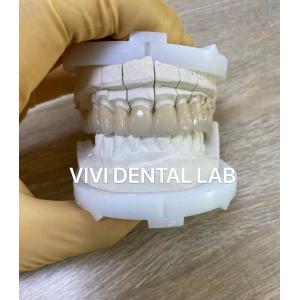 Precise Dental Lab Crowns Esthetic Porcelain Zirconia Tooth Crown
