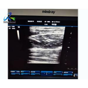 Mindray DC-3 Abnormal Image Ultrasound Machine Repair Solutions Health Medical Equipment