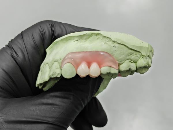 Flexible Resin vs Hard Resin Better Elasticity and Softness for Invisible Denture Base Resin