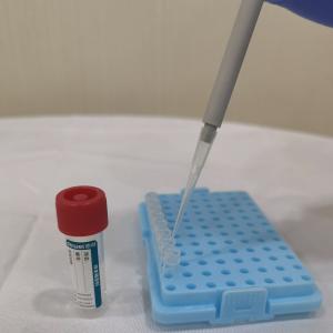 China Sample Release Kit Flocked Swab RNA Preservation and Extraction Tube Directly on PCR Amplification wholesale