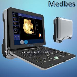 4D Portable Color Ultrasound System Scanner Color Doppler Ultrasound Scanner is Based on Windows