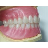 China Ivoclar Teeth Full Acrylic Denture Prosthesis Easy To Clean High Durability on sale