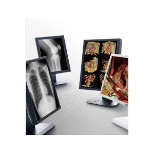 China Clear picture Medical Grade Displays , 5MP Gray Scale Medical Display supplier