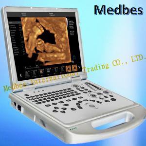 China Canyearn A75 Full Digital B/W Portable Ultrasonic Diagnostic Ultrasound System supplier