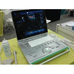 China 3D Laptop Ultrasound Scanner Color Doppler Machine With Large Volume Hardisk supplier