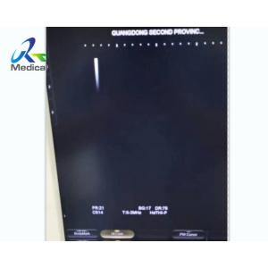 Aloka Image No Probe Image Ultrasound Machine Repair Cell Board