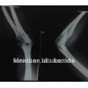 Konidaの医学の乾燥したフィルム高リゾリューション熱抵抗イメージ投射