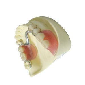Custom Made Dental Lab Products Polymer Removable Partial Dentures