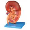 China Kidney Enlargement Human Anatomy Model Shows the Section for Colleges Training wholesale