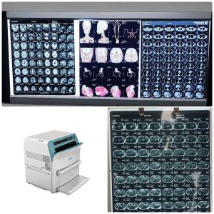 China Niveau bas X médical Ray Blue Film de brouillard 200±5μM High Sharpness supplier