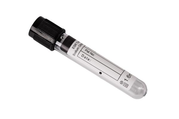 2ml ESR Blood Collection Tube with Sodium Citrate Anticoagulant
