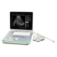 Portable ultrasound machine Laptop Ultrasound machine SU-7S with CE
