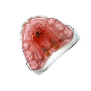 High Hardness FDA Functional Appliance Orthodontic Rubber Retainer