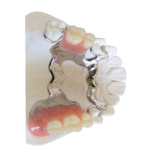 3D Printing PFM Dental Crown Customized High Biological Intermiscibility