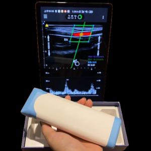 High Performance Electronic Linear Array PICC Handheld Ultrasound Scanner