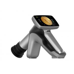 China Auto Focus Medical Video Ophthalmoscope With FOV 45° supplier