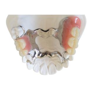 OEM 3D Printer PFM Dental Crown Bridge High Biological Intermiscibility
