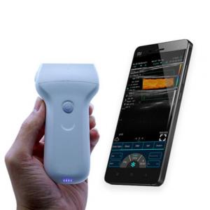 96 Element Wireless Ultrasound Probe Mobile Ultrasound Scanner