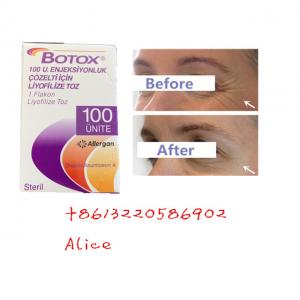 China Anti Aging Anti Wrinkle Botulinum Toxin Allergan Type A Botox Powder supplier